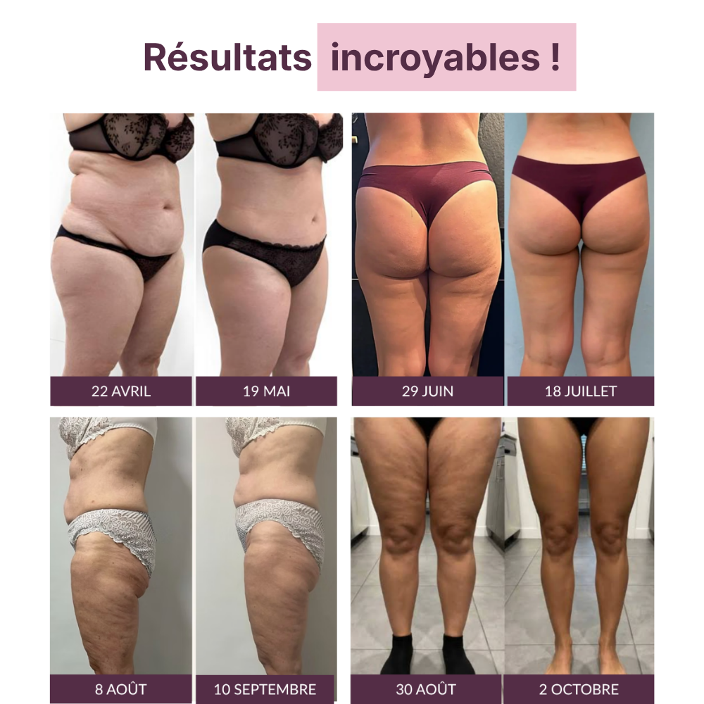 Cellulifit - Le legging 3D anti-cellulite